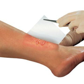 SOLVALINE N 10X10CM HAAVATYYNY STER